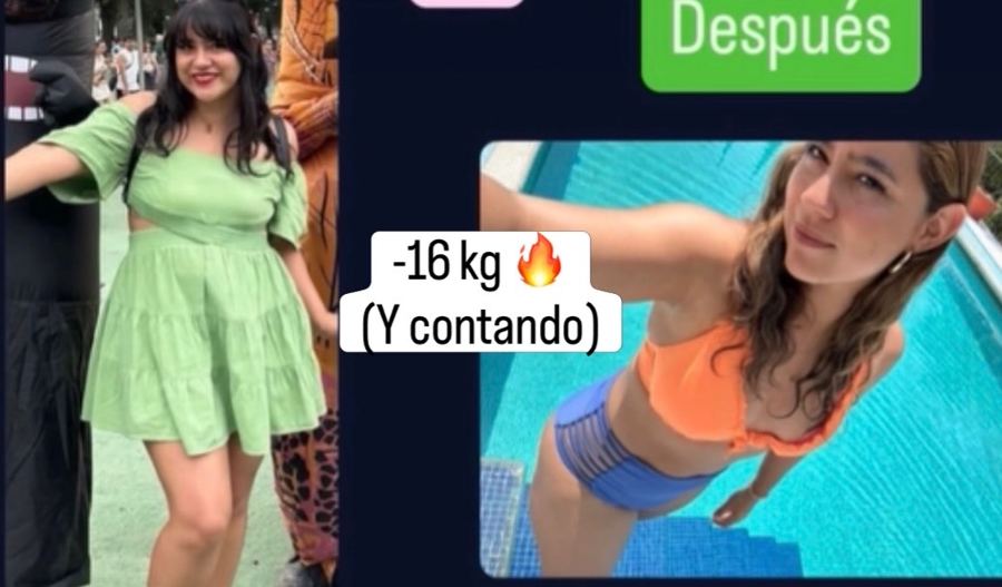 Antes y después de Ana